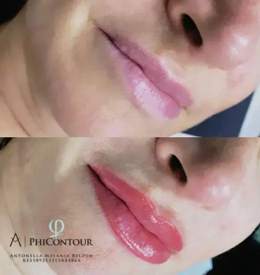 Micropigmentación de Labios: Una Técnica para Resaltar tu Belleza Natural